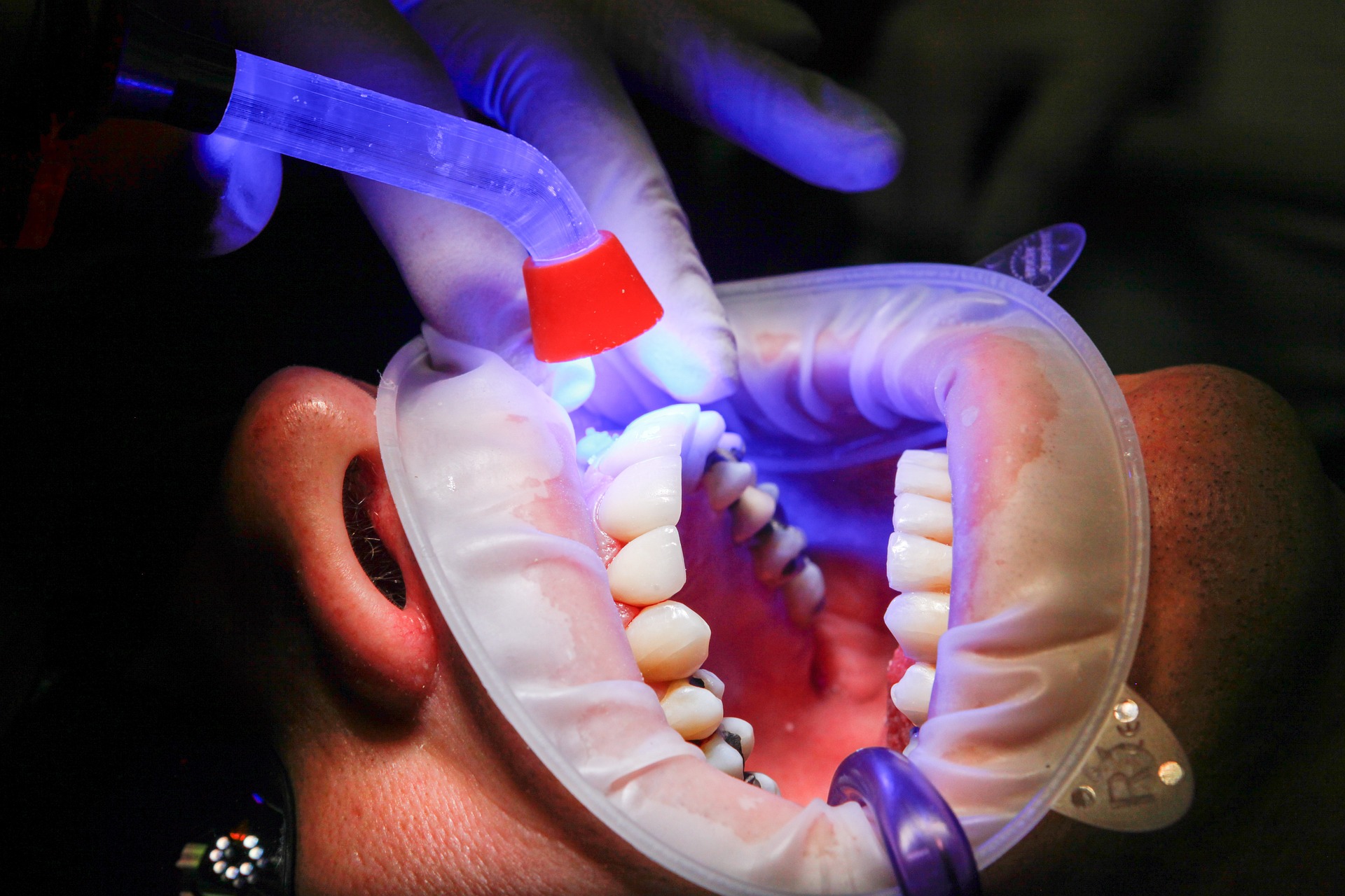 Shinning Smile Solutions dental care